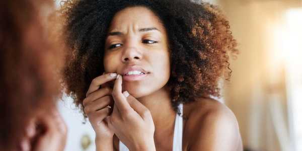 Preventing Acne Scars: 5 Skincare Tips That Actually Work
